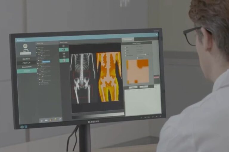 MOC-densitometria ossea risultati